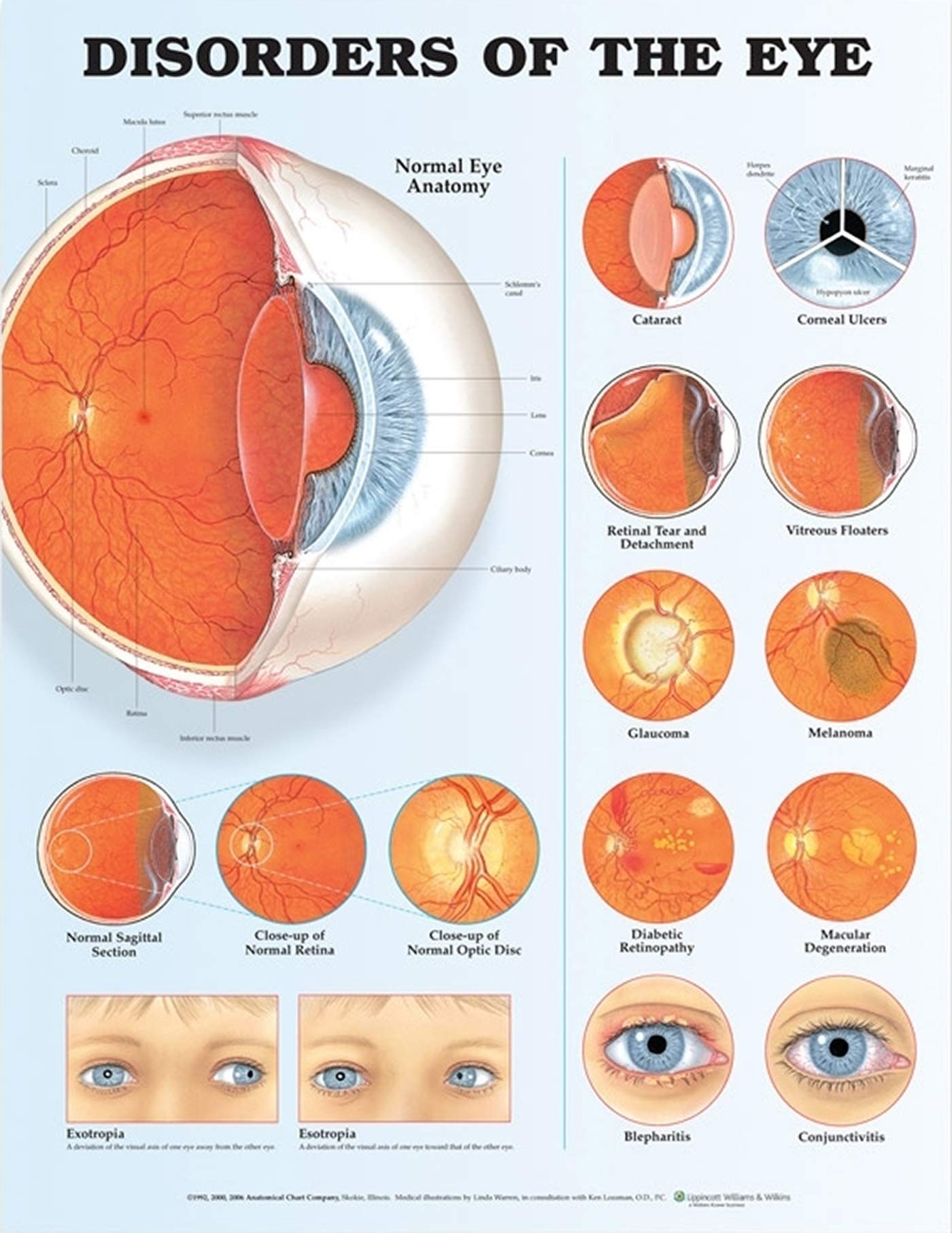 case study of eye disease
